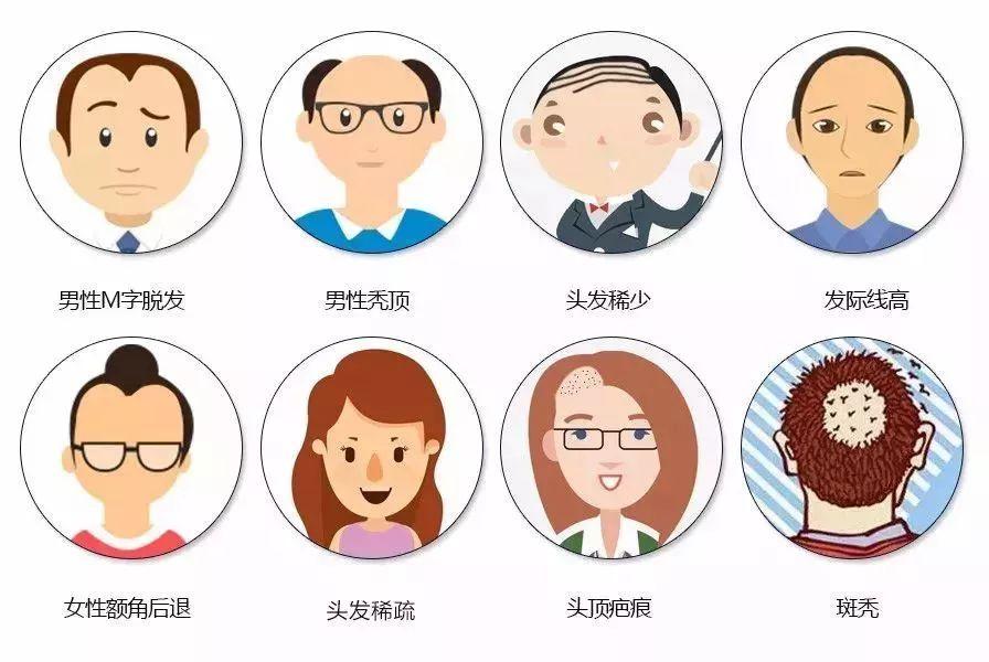 脱发的季节，如何应对季节性脱发问题