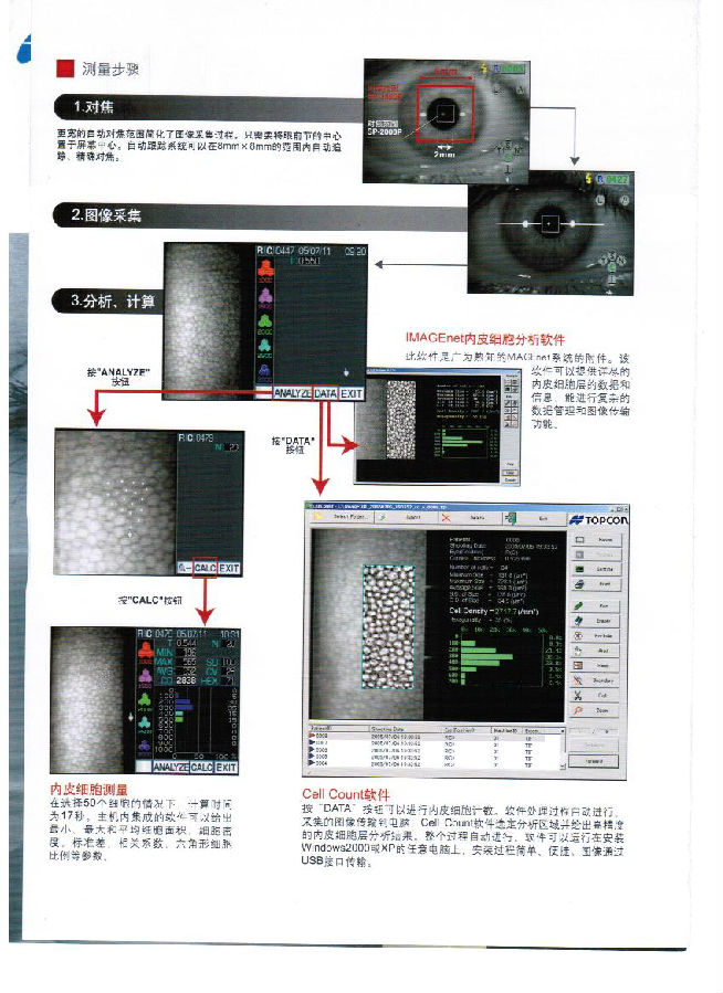 角膜内皮细胞计——揭示眼部健康的秘密武器