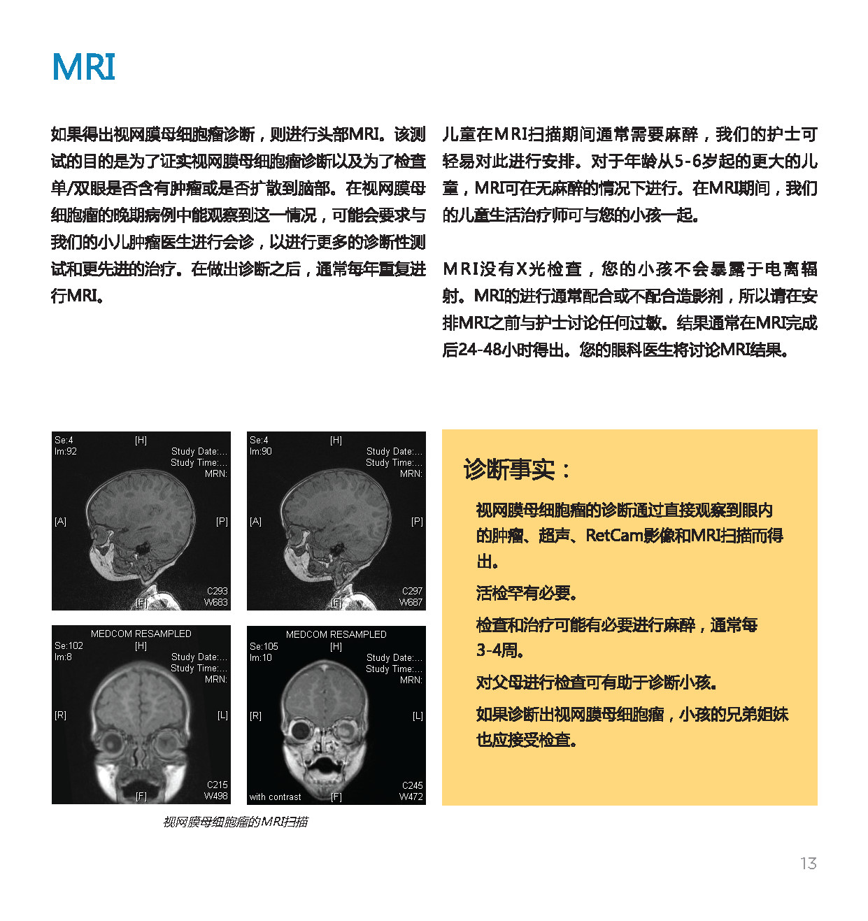 视母细胞瘤表现及其影响