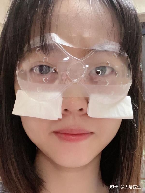 近视眼手术后的眼罩，功能与重要性分析