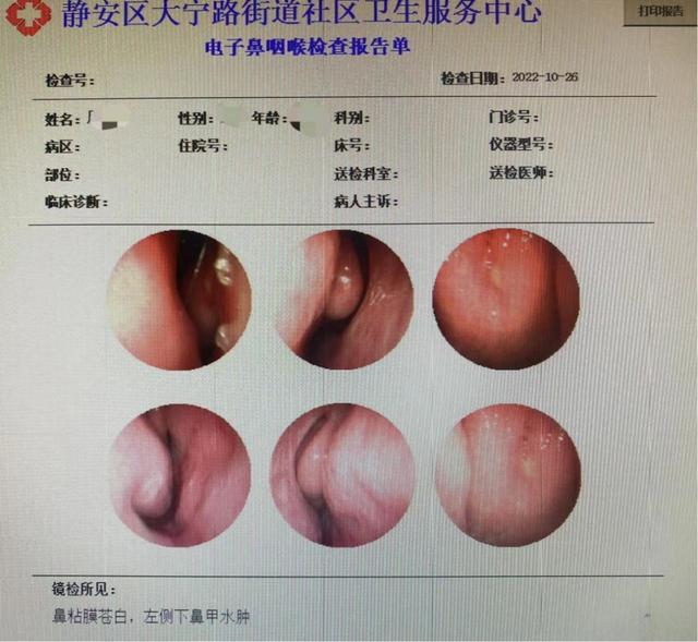 探索鼻子内部红肿发炎，成因、症状与治疗方法