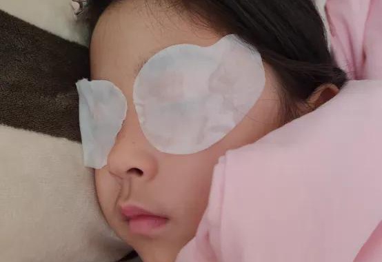 半飞秒手术后眼罩的正确佩戴方式——关于半飞秒眼罩的佩戴指南