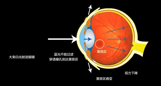 如何辨别真假蓝光眼镜