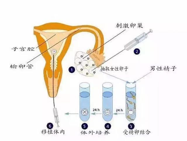试管取卵，卵子多大才适合采集？
