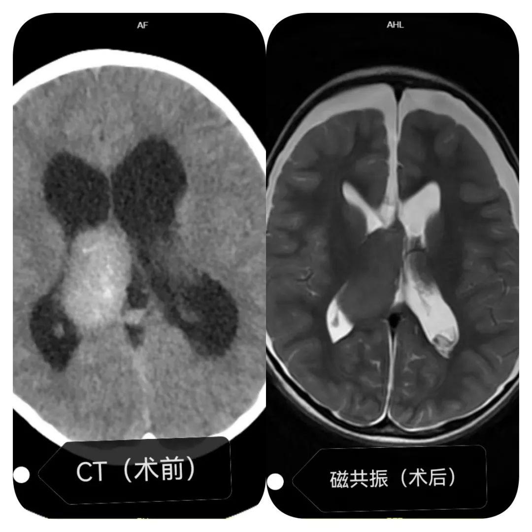 江西手术室自动门，智能化手术室建设的核心要素